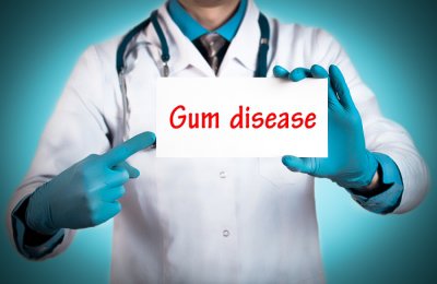 Doctor holding banner of gum disease