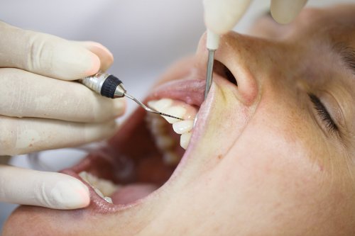 Dentist is examining the patient's teeth