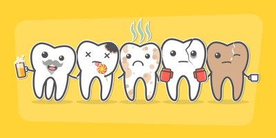 Image of Tooth decay