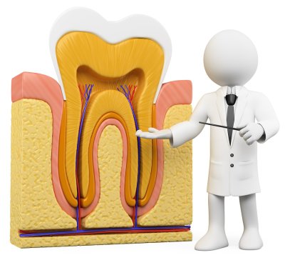 Image of a root canal